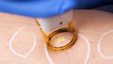  Spider Vein Treatment Center 983 Park Avenue, Ste 1D11 
