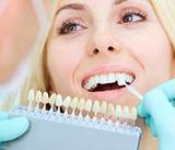 Dental Crown Pennsylvania | Media Brite Smile, Media