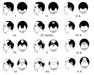  Profile Photos of Elixir Hair Transplant Clinic Islamabad House No.5-A, Double Road, F-11/1, Islamabad, Pakistan - Photo 6 of 8