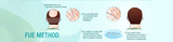 Adron Cosmetic Surgery | Hair Transplant Ahmedabad, Ahmedabad