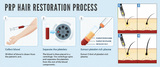 Adron Cosmetic Surgery | Hair Transplant Ahmedabad, Ahmedabad