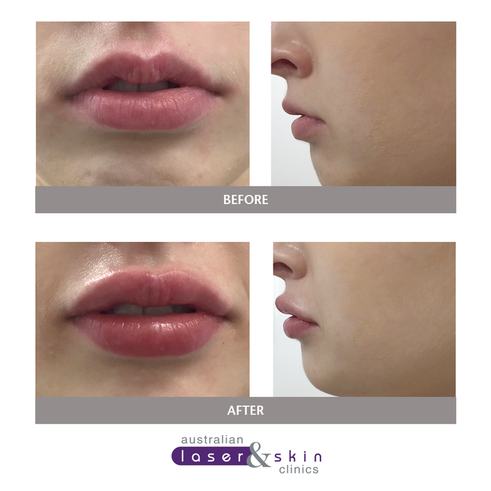  New Album of Australian Laser & Skin Clinics 8 Pascoe Vale Road - Photo 4 of 14