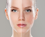 Australian Laser & Skin Clinics, Moonee Ponds