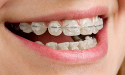  Profile Photos of Waldman Orthodontics 8641 Wilshire Blvd., Suite 310 - Photo 2 of 8
