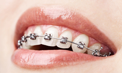  Profile Photos of Waldman Orthodontics 8641 Wilshire Blvd., Suite 310 - Photo 4 of 8