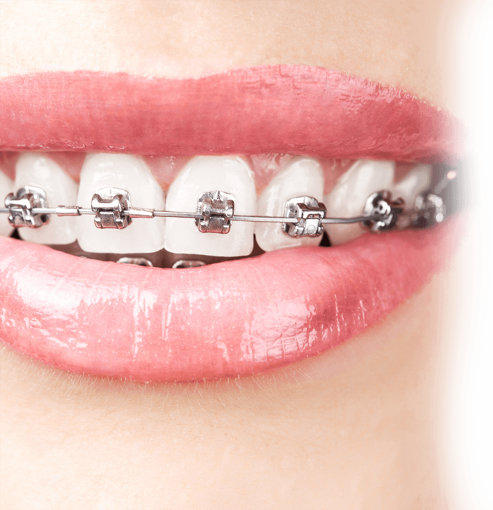 Profile Photos of Watford Orthodontics Wilmington Close - Photo 4 of 7