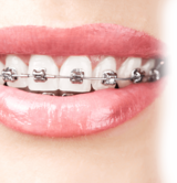  Watford Orthodontics Wilmington Close 