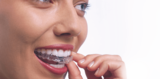  Watford Orthodontics Wilmington Close 