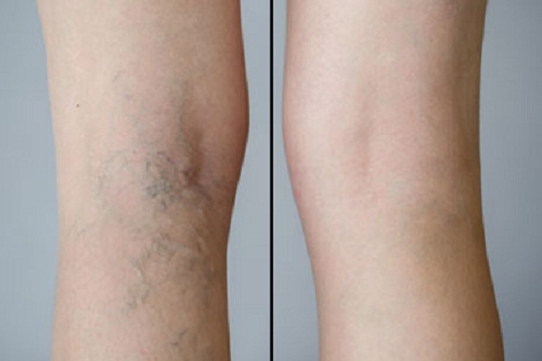  Profile Photos of Vein Institute & Pain Centers of America 41 Park Ave ste 1c - Photo 1 of 2