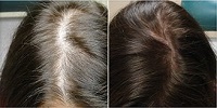  Profile Photos of Sani PRP Hair MD 15075 Los Gatos Blvd, Ste #150 - Photo 1 of 2