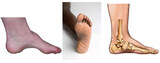 Do I need Custom Made Orthotics? - https://mayaphysio.ca/blog/do-i-need-custom-made-orthotics/, Joseph Kitchen and Bath, Thornhill