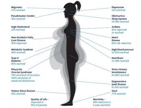  New Album of Surgical Weight Loss Centre Pindara Place, 14/13 Carrara St - Photo 4 of 13