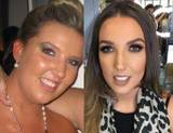  Surgical Weight Loss Centre Pindara Place, 14/13 Carrara St 