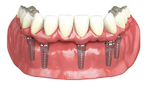  Profile Photos of Belmont Dental Centre 610 Sixth St #108, - Photo 1 of 1