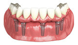 Belmont Dental Centre, New Westminister