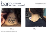  Bare Tattoo & Hair Removal 2719 North Halsted Street 