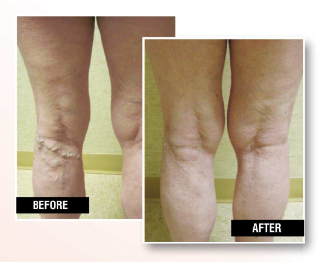  Profile Photos of USA Vein Clinics 2444 86th St, Ste A - Photo 2 of 6