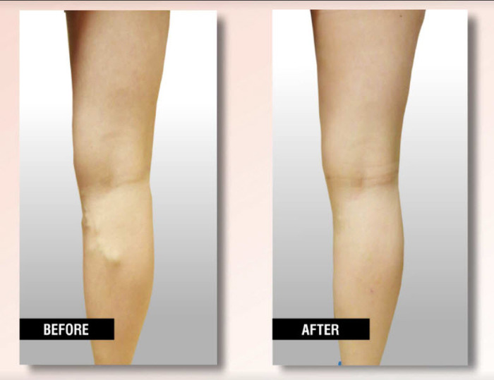  Profile Photos of USA Vein Clinics 924 Flatbush Ave - Photo 2 of 6