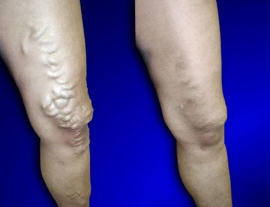  Profile Photos of USA Vein Clinics 924 Flatbush Ave - Photo 4 of 6