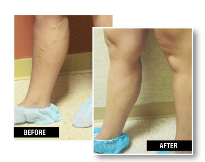  Profile Photos of USA Vein Clinics 495 Winn Way, Ste 222 - Photo 5 of 6