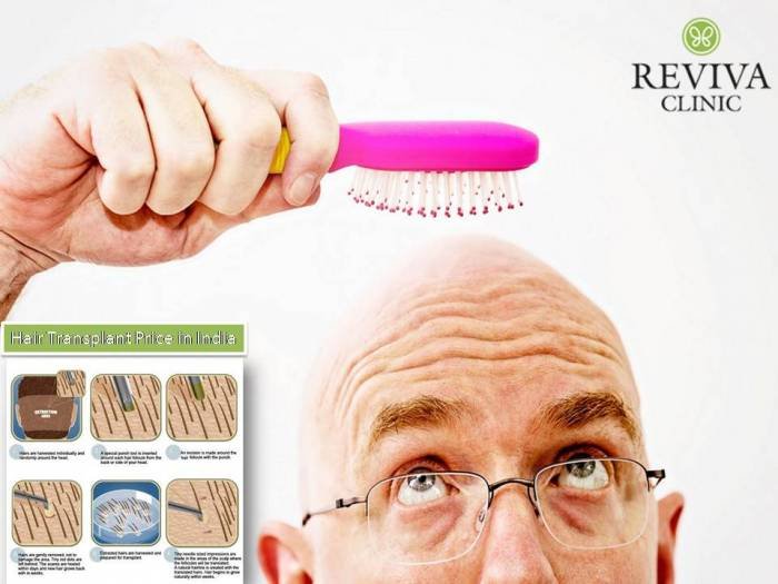 Hair Transplant Price in India Profile Photos of Hair Transplant Price in India SCO No. 1-2-3 F.F, Sector : 17 D, Opp. Park Plaza Hotel, Backside Canadian Embassy - Photo 1 of 1