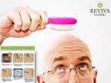 Hair Transplant Price in India, Hair Transplant Price in India, Chandigarh