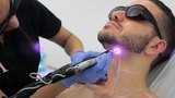 Laser Hair Removal Abu Dhabi, Abu dhabi