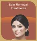 Scar Removal Treatment
, SkinCityIndia, Pune