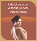 Safe Liposuction without general anaesthesia, SkinCityIndia, Pune