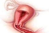  OBGYN NYC- Anat Zelmanovich, MD. Serving 
