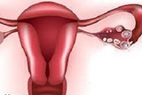  OBGYN NYC- Anat Zelmanovich, MD. Serving 