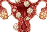 OBGYN NYC- Anat Zelmanovich, MD., New York