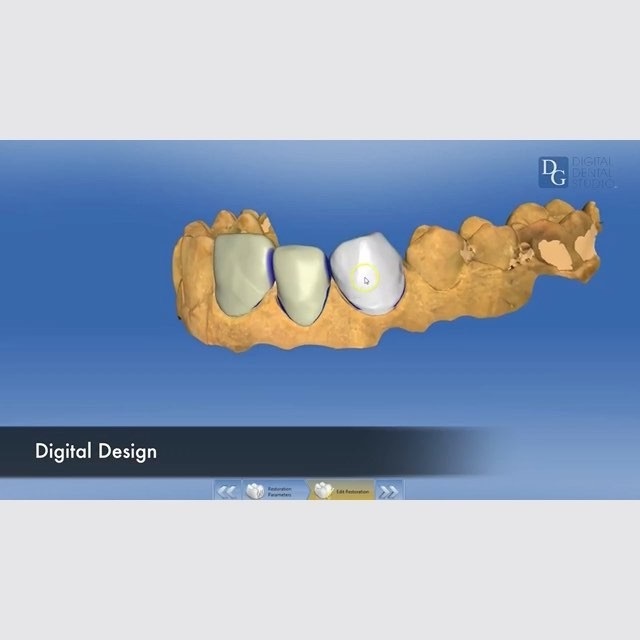  New Album of Dental Crowns Lab 28-10 Queens Plz S - Photo 5 of 8