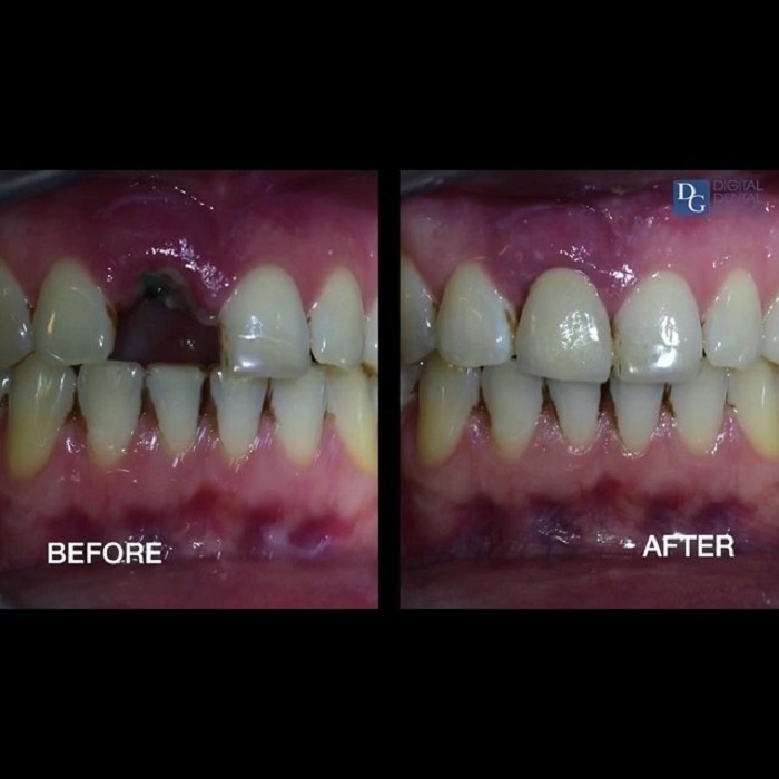  New Album of Dental Crowns Lab 28-10 Queens Plz S - Photo 7 of 8