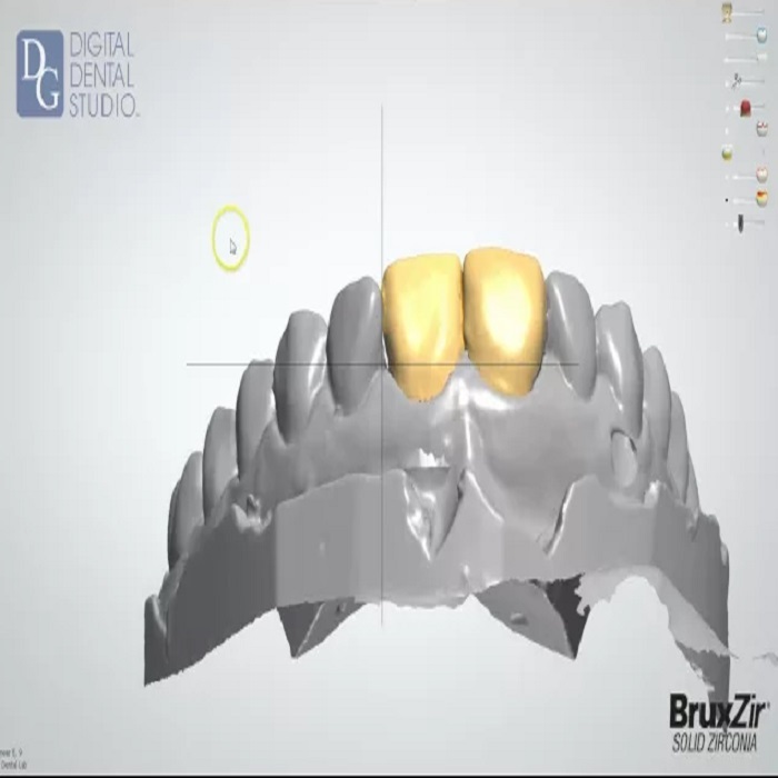  New Album of Dental Crowns Lab 28-10 Queens Plz S - Photo 8 of 8