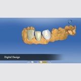 Dental Crowns Lab, Long Island City