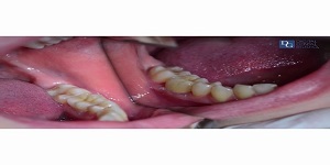  Profile Photos of Dental Crowns Lab Elizabeth 10 North Ave - Photo 3 of 6