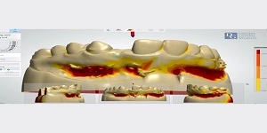  Profile Photos of Dental Crowns Lab Elizabeth 10 North Ave - Photo 4 of 6