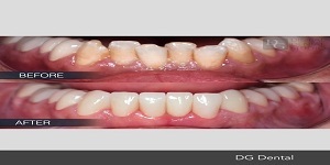  Profile Photos of Dental Crowns Lab Elizabeth 10 North Ave - Photo 5 of 6