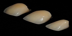  Profile Photos of Dental Crowns Lab Elizabeth 10 North Ave - Photo 6 of 6