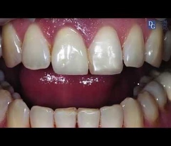  New Album of DG Dental Lab Elizabeth 315 Elmora Ave - Photo 1 of 7