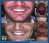 Precision Dental Clinic, Dubai