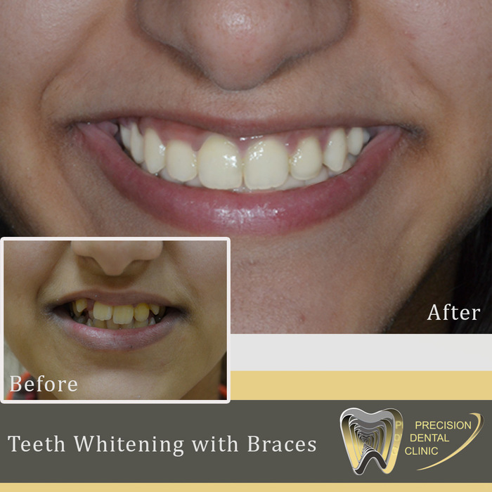  New Album of Precision Dental Clinic Office 23 01 Aspin Commercial Tower Sheikh Zayed Road, Dubai. - Photo 1 of 1