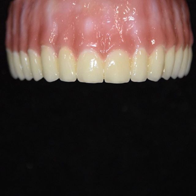  New Album of Dental Crowns Lab Paterson 185 6th Ave - Photo 4 of 6