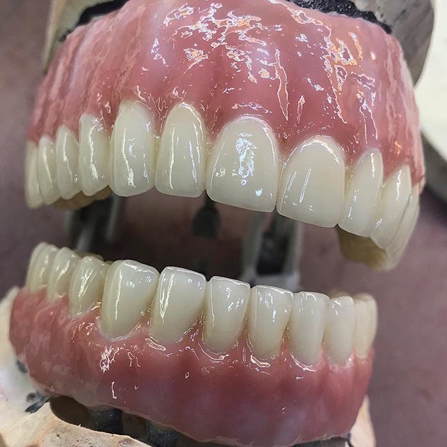  New Album of Dental Crowns Lab Paterson 185 6th Ave - Photo 5 of 6
