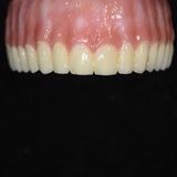 Dental Crowns Lab Paterson, Paterson