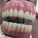 Dental Crowns Lab Paterson, Paterson