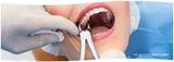 Dental Crowns Lab Paterson, Paterson