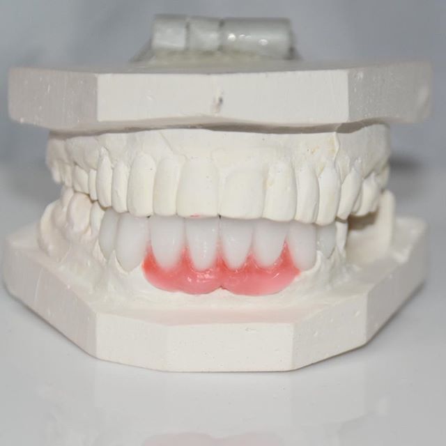  Profile Photos of Dental Crowns Lab Newark N/A - Photo 5 of 5