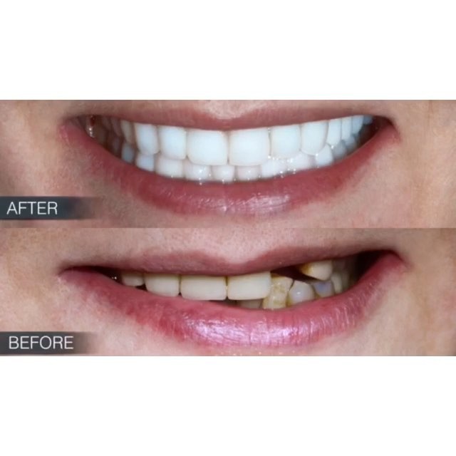  Profile Photos of Dental Crowns Lab Newark N/A - Photo 1 of 5